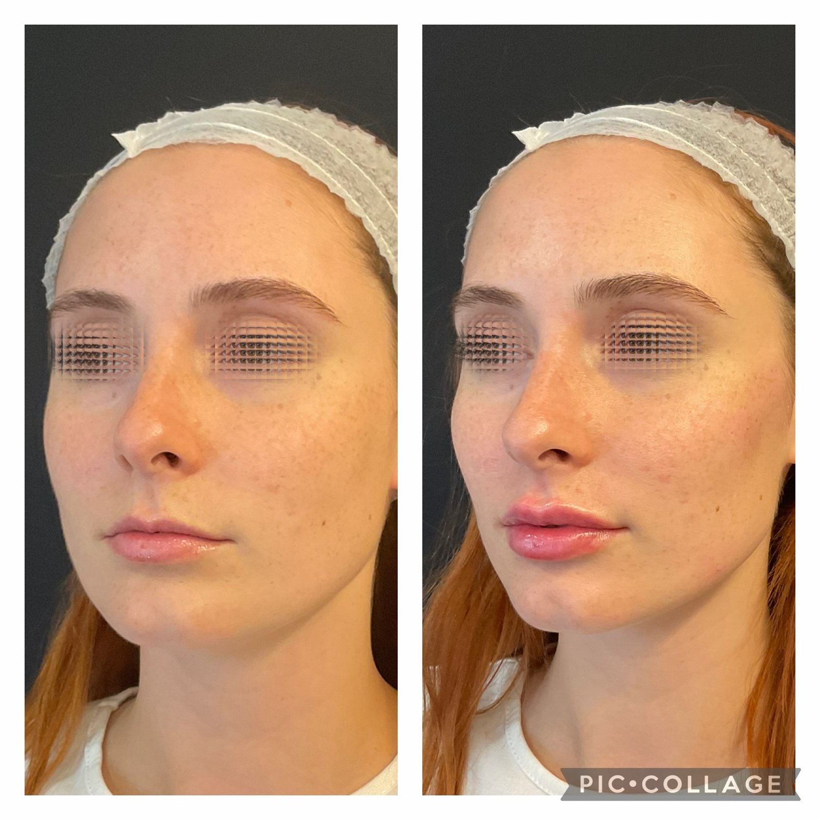 Rejuvenescimento